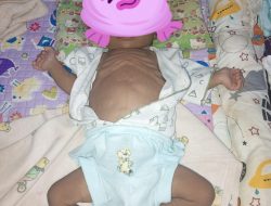Muhamad Rasyid Abdilah Penderita Sakit Gizi Buruk Butuh Perhatian Pemerintah dan Uluran Tangan Masyarakat.